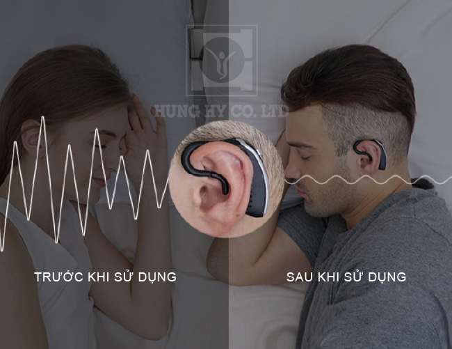 Hiệu quả sau khi dùng tai nghe Snore Circle chống ngáy thông minh